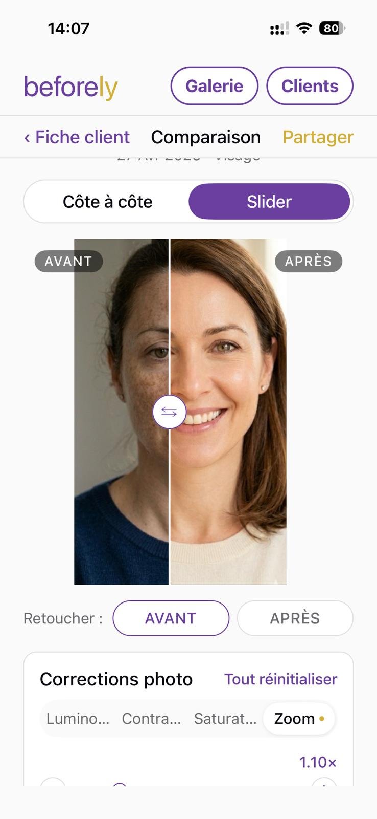 Comparaison slider avant/après